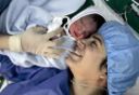 Il parto cesareo: una scelta non discriminante per le future mamme